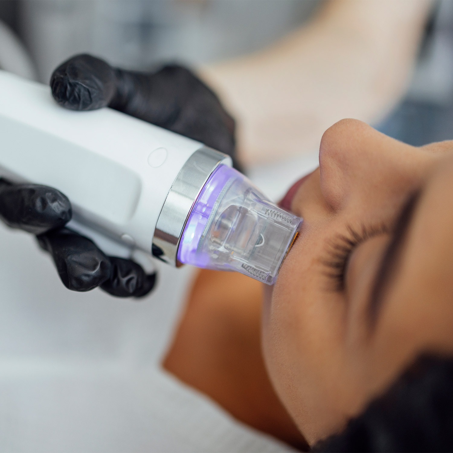 GK Aesthetics Kosmetikinstitut Essen Ruettenscheid Leistung Microneedling