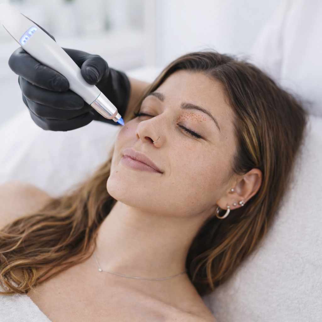 GK Aesthetics Kosmetikinstitut Essen Ruettenscheid Behandlungen Plasmapen